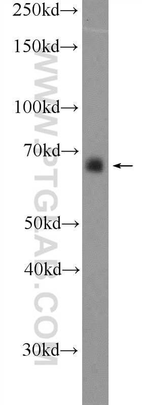 Western Blot (WB) analysis of HEK-293T cells using RBM39 Polyclonal antibody (21339-1-AP)