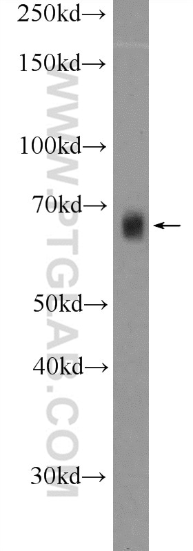 Western Blot (WB) analysis of HEK-293T cells using RBM39 Polyclonal antibody (21339-1-AP)