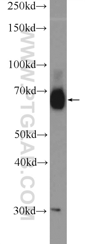 Western Blot (WB) analysis of HEK-293T cells using RBM39 Polyclonal antibody (21339-1-AP)