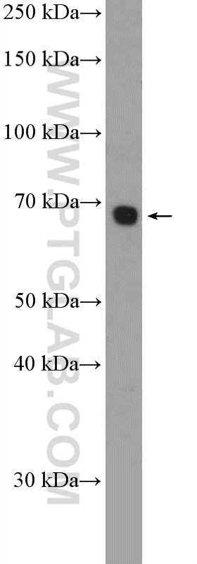 Western Blot (WB) analysis of HEK-293T cells using RBM39 Polyclonal antibody (21339-1-AP)