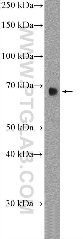 Western Blot (WB) analysis of HEK-293T cells using RBM39 Polyclonal antibody (21339-1-AP)