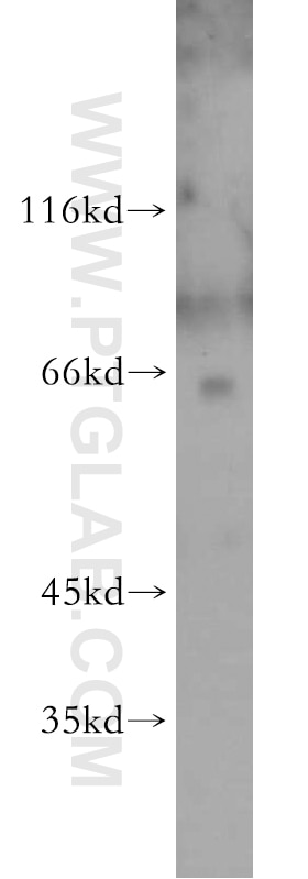 Western Blot (WB) analysis of human skeletal muscle tissue using RBM39 Polyclonal antibody (21339-1-AP)