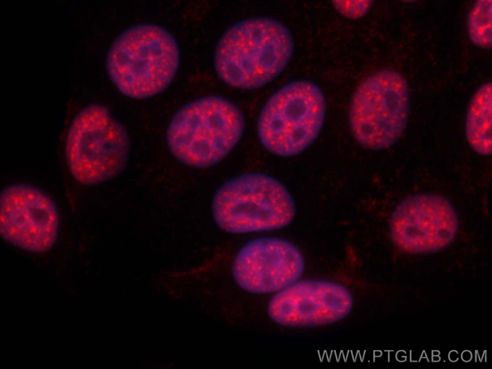 IF Staining of HepG2 using CL594-67420