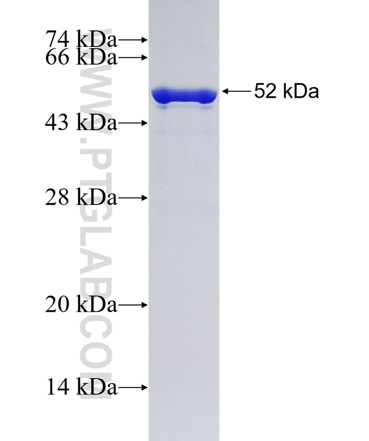 RBM39 fusion protein Ag15584 SDS-PAGE