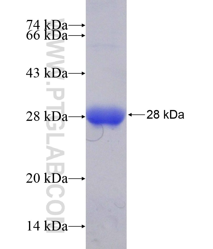 RBM39 fusion protein Ag15766 SDS-PAGE