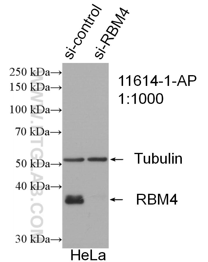 Western Blot (WB) analysis of HeLa cells using RBM4 Polyclonal antibody (11614-1-AP)