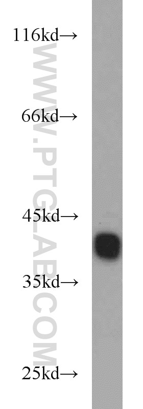 Western Blot (WB) analysis of human brain tissue using RBM4 Polyclonal antibody (11614-1-AP)