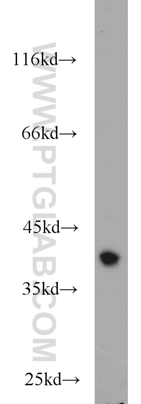 Western Blot (WB) analysis of mouse brain tissue using RBM4 Polyclonal antibody (11614-1-AP)