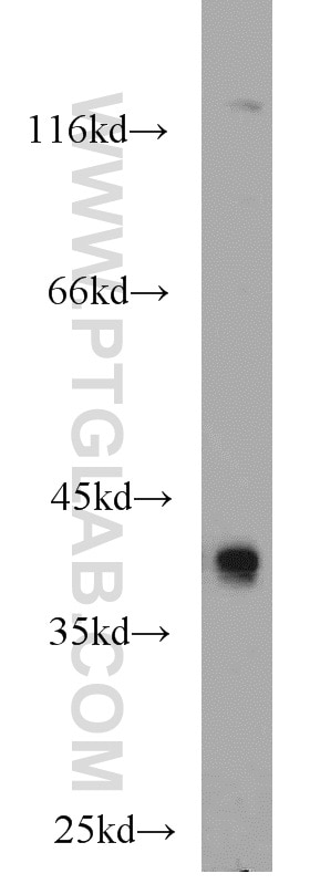 Western Blot (WB) analysis of mouse brain tissue using RBM4 Polyclonal antibody (11614-1-AP)