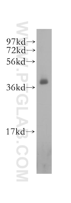 Western Blot (WB) analysis of human heart tissue using RBM4 Polyclonal antibody (11614-1-AP)