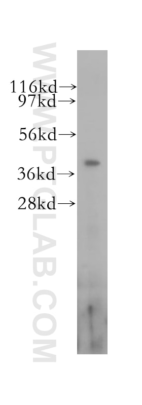 Western Blot (WB) analysis of human brain tissue using RBM4 Polyclonal antibody (11614-1-AP)