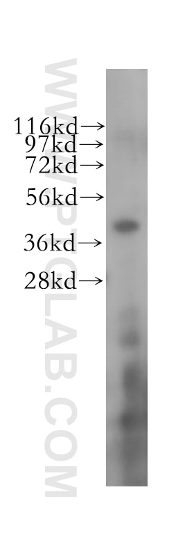 Western Blot (WB) analysis of human kidney tissue using RBM4 Polyclonal antibody (11614-1-AP)