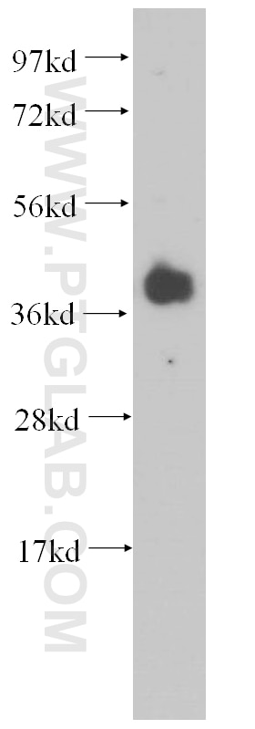Western Blot (WB) analysis of mouse brain tissue using RBM4 Polyclonal antibody (11614-1-AP)