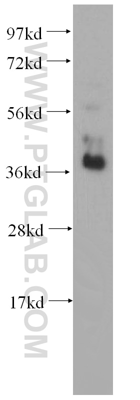 Western Blot (WB) analysis of human heart tissue using RBM4 Polyclonal antibody (11614-1-AP)