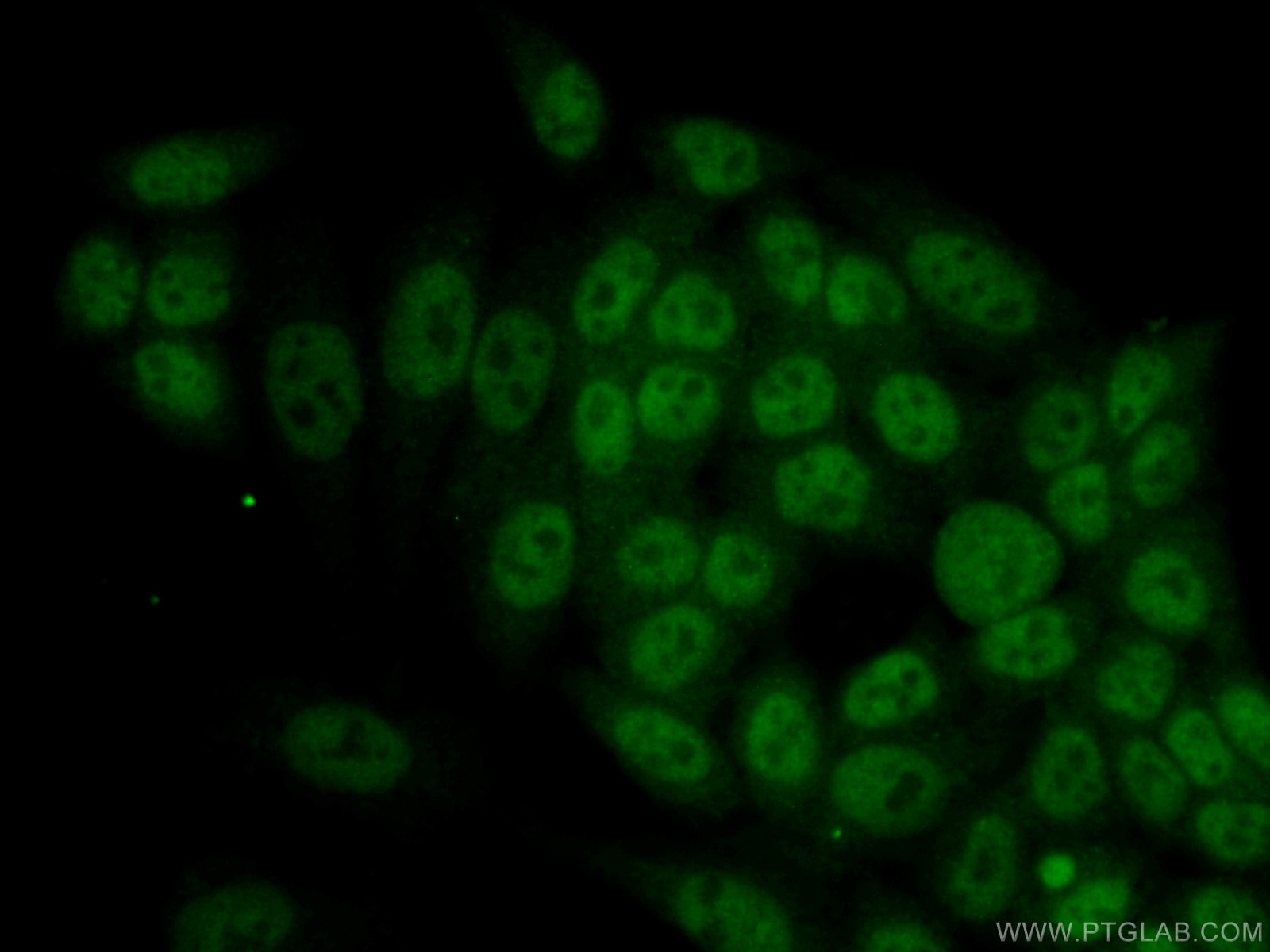 Immunofluorescence (IF) / fluorescent staining of HeLa cells using RBM4 Monoclonal antibody (60292-1-Ig)