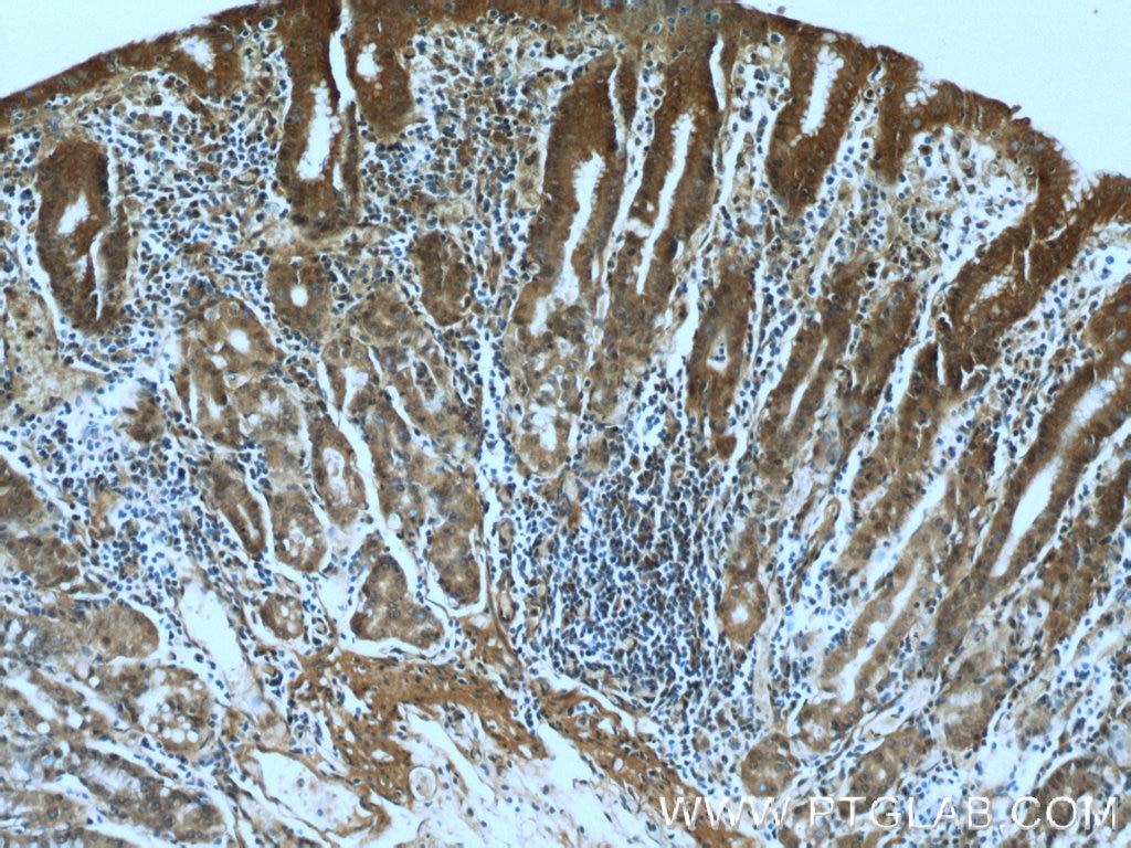 Immunohistochemistry (IHC) staining of human stomach tissue using RBM4 Monoclonal antibody (60292-1-Ig)