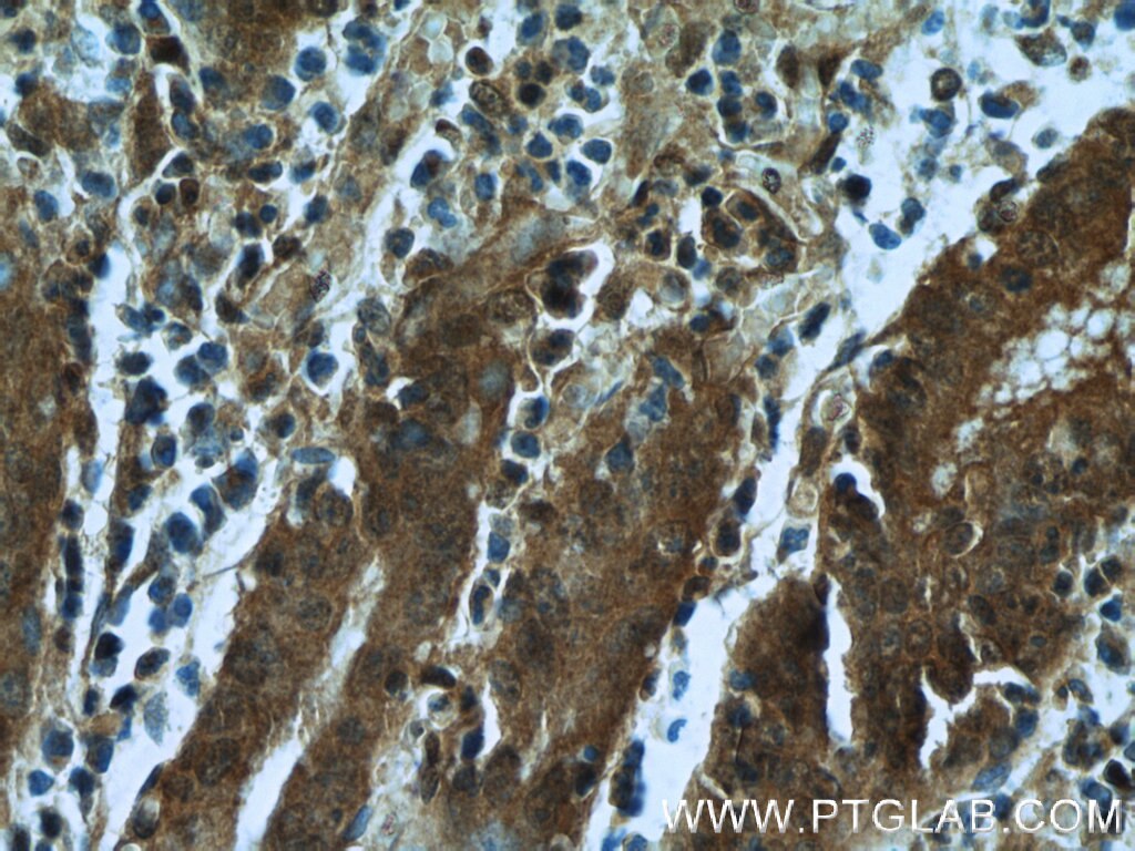 Immunohistochemistry (IHC) staining of human stomach tissue using RBM4 Monoclonal antibody (60292-1-Ig)