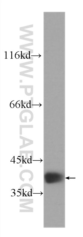 Western Blot (WB) analysis of fetal human brain tissue using RBM4 Monoclonal antibody (60292-1-Ig)