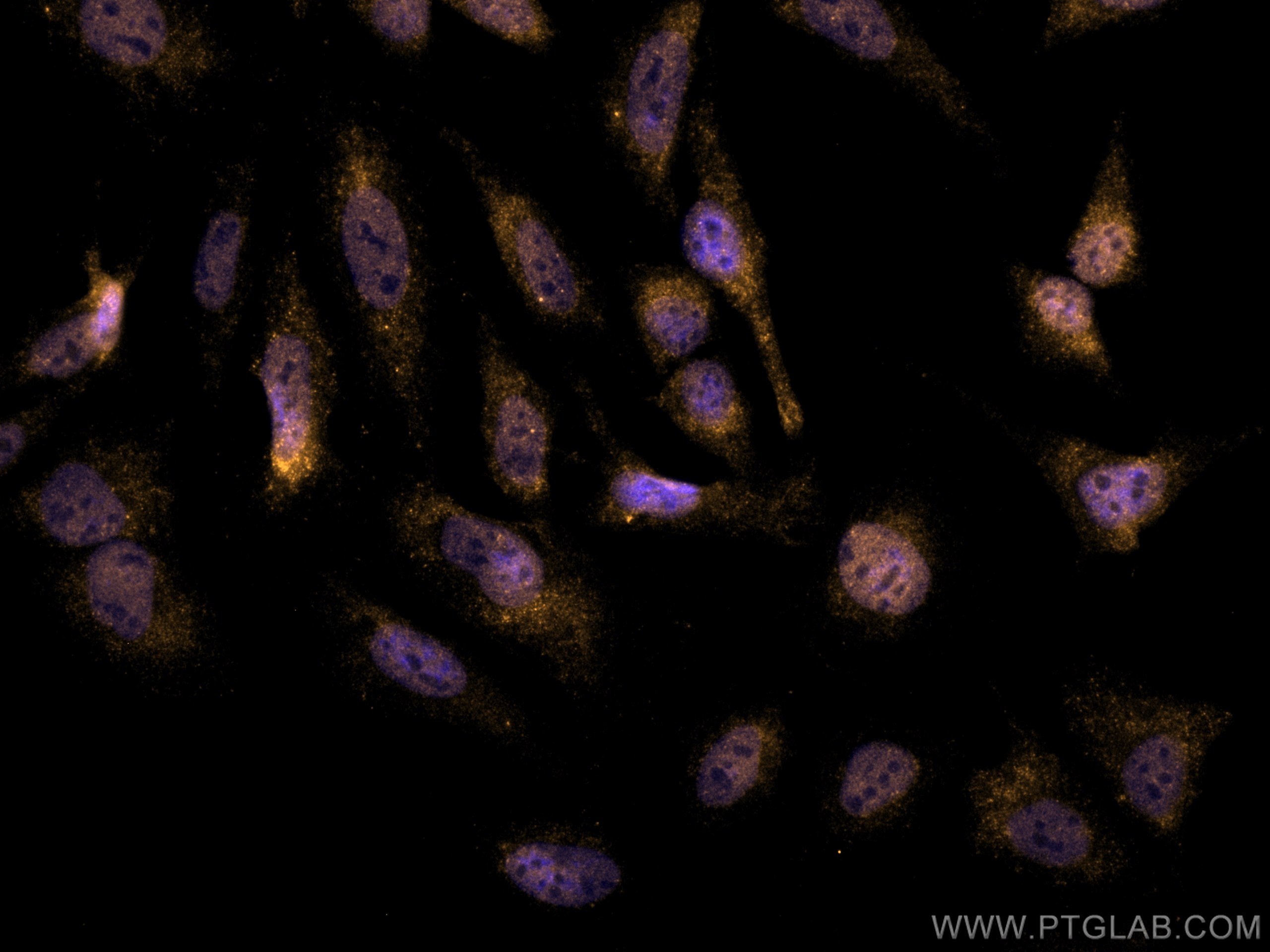 Immunofluorescence (IF) / fluorescent staining of HeLa cells using CoraLite®555-conjugated RBM4 Monoclonal antibody (CL555-60292)