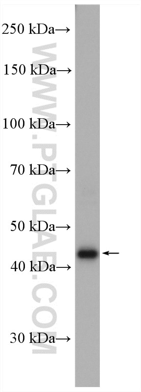 Western Blot (WB) analysis of A549 cells using RBM41 Polyclonal antibody (15784-1-AP)