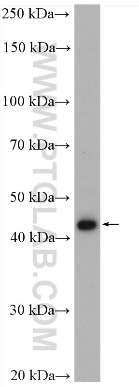 Western Blot (WB) analysis of SGC-7901 cells using RBM41 Polyclonal antibody (15784-1-AP)