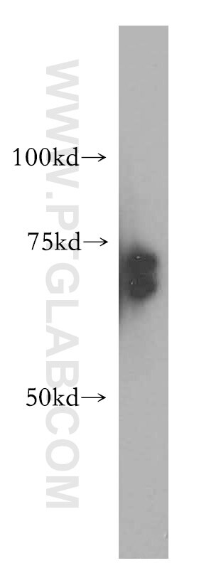 Western Blot (WB) analysis of HeLa cells using RBM42 Polyclonal antibody (15407-1-AP)