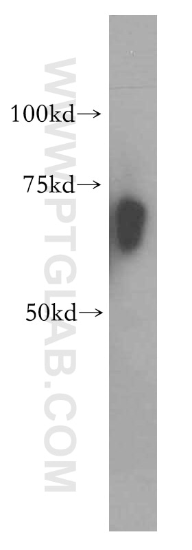 Western Blot (WB) analysis of human liver tissue using RBM42 Polyclonal antibody (15407-1-AP)