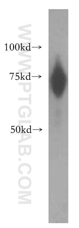 Western Blot (WB) analysis of HEK-293 cells using RBM42 Polyclonal antibody (15407-1-AP)