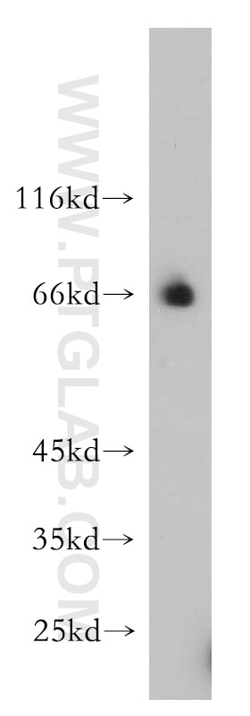 Western Blot (WB) analysis of HepG2 cells using RBM42 Polyclonal antibody (15407-1-AP)