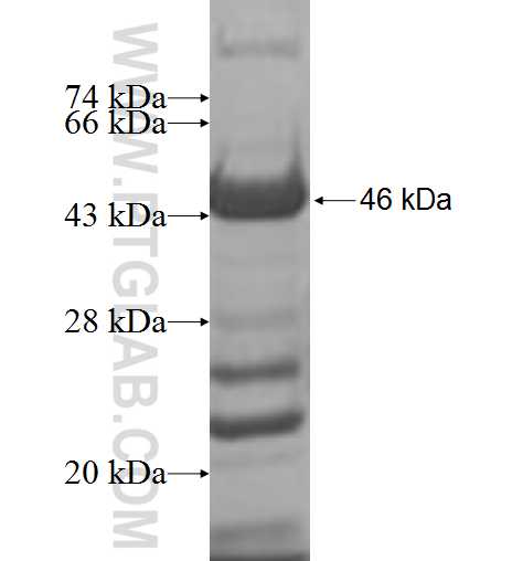 RBM42 fusion protein Ag7418 SDS-PAGE RBM42 fusion protein Ag7418 SDS-PAGE