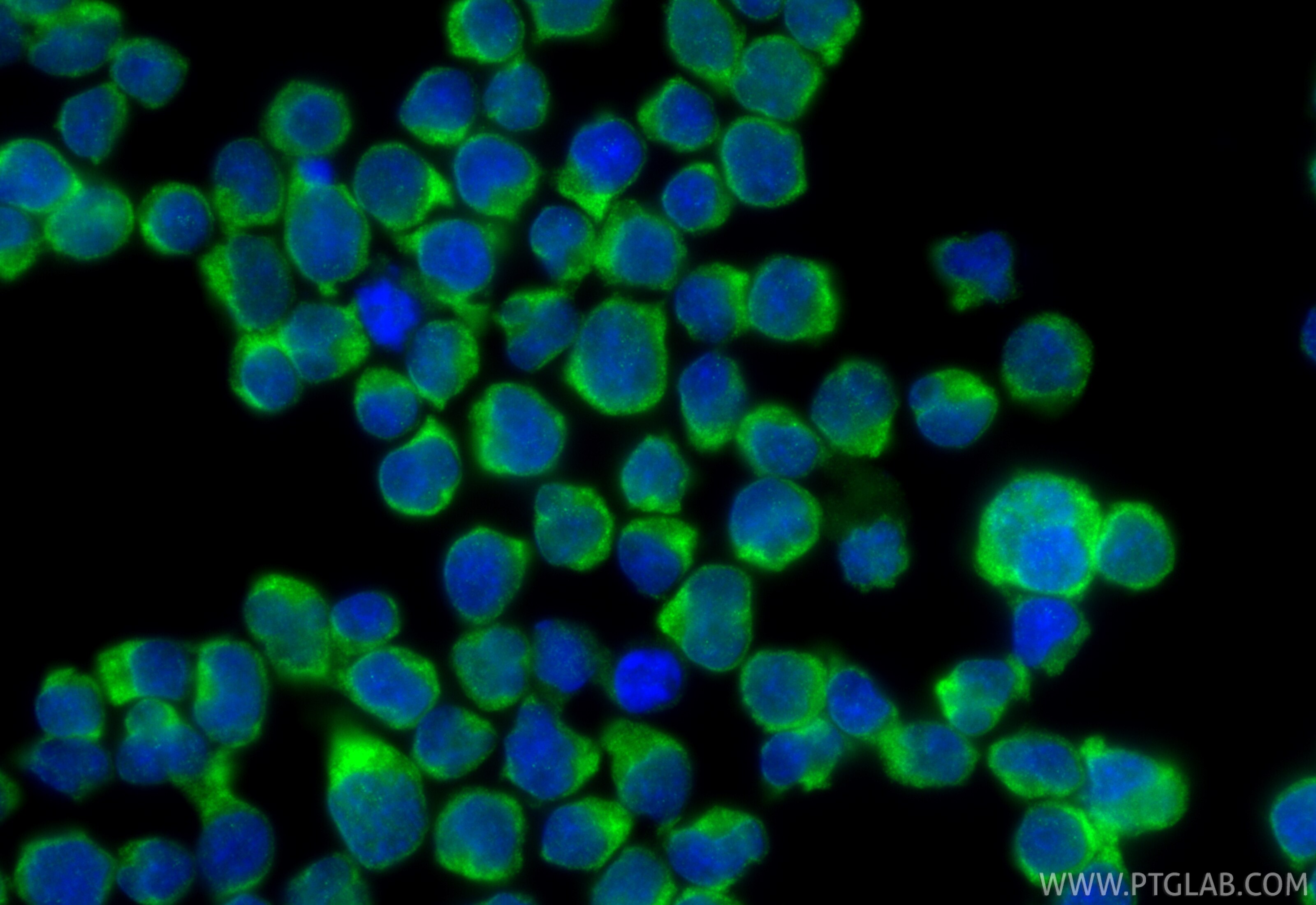 Immunofluorescence (IF) / fluorescent staining of Jurkat cells using RBM46 Polyclonal antibody (24368-1-AP)