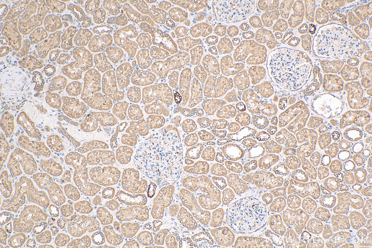 Immunohistochemistry (IHC) staining of human kidney tissue using RBM46 Polyclonal antibody (24368-1-AP)