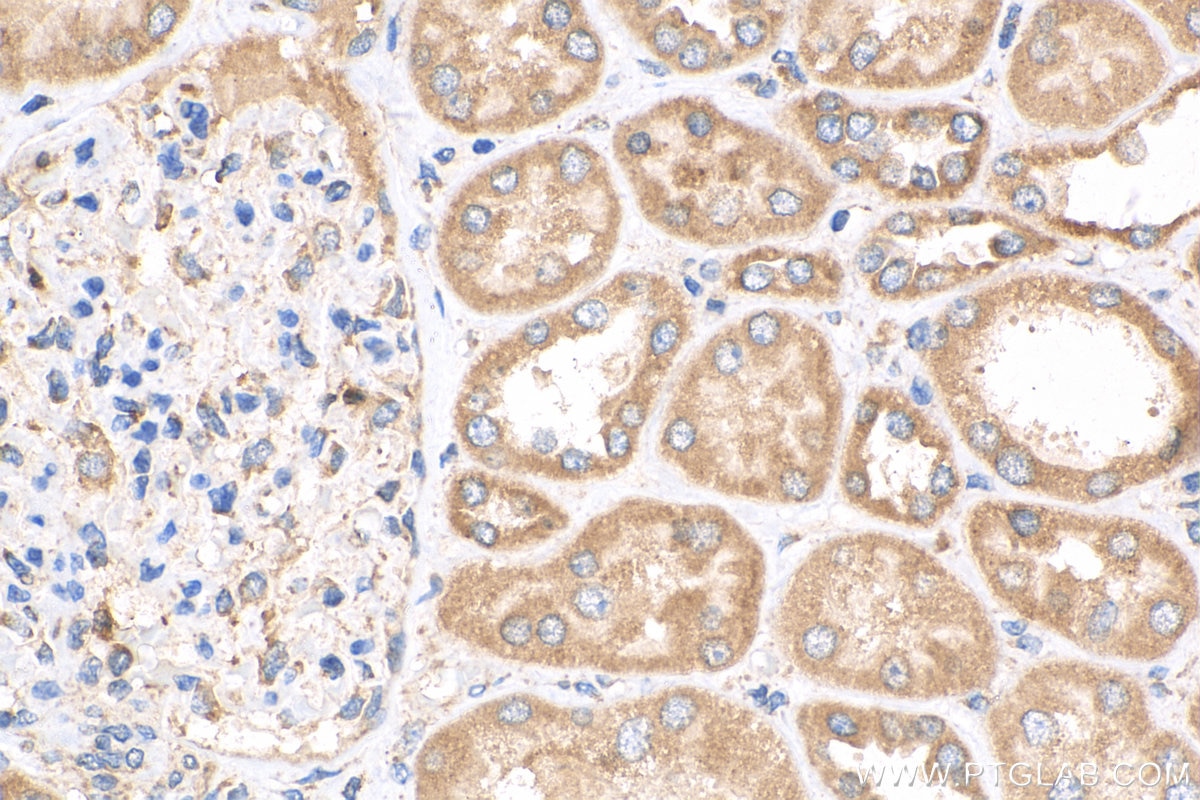 Immunohistochemistry (IHC) staining of human kidney tissue using RBM46 Polyclonal antibody (24368-1-AP)