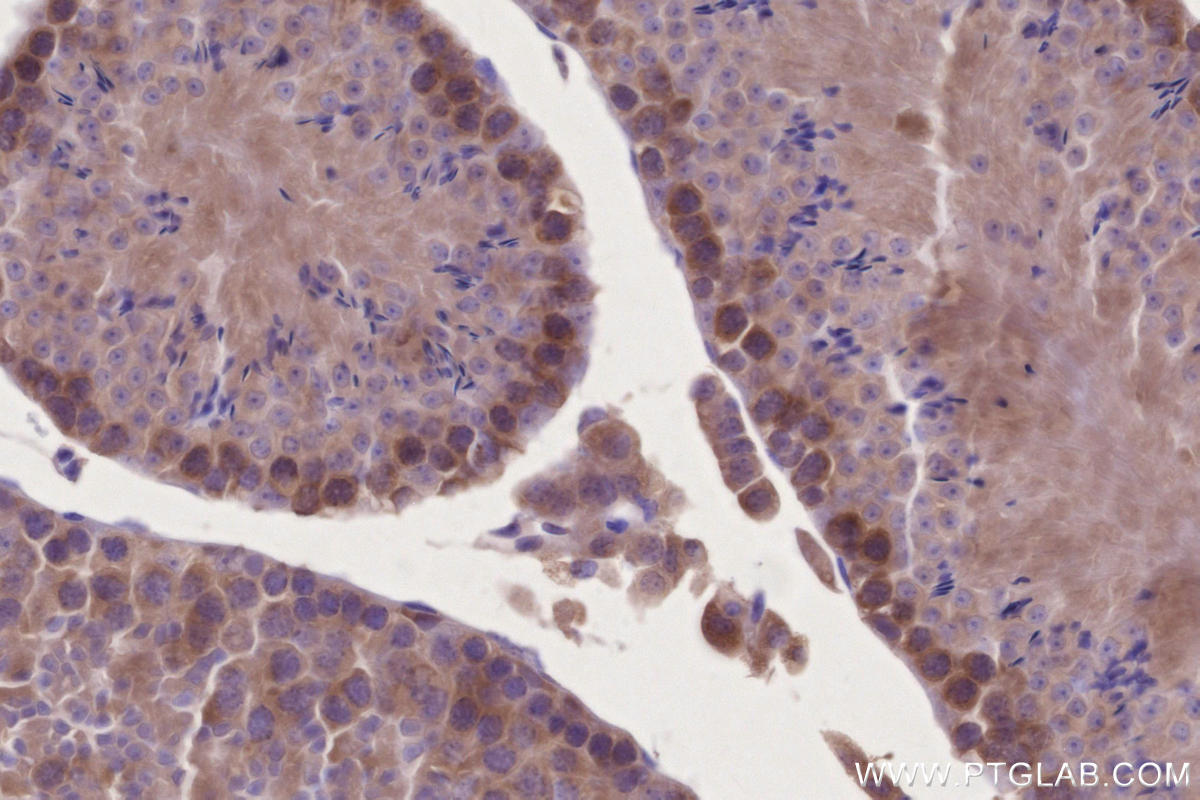 Immunohistochemistry (IHC) staining of mouse testis tissue using RBM46 Polyclonal antibody (24368-1-AP)