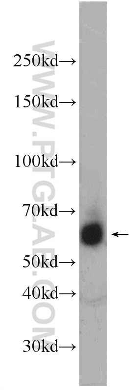 Western Blot (WB) analysis of Jurkat cells using RBM46 Polyclonal antibody (24368-1-AP)