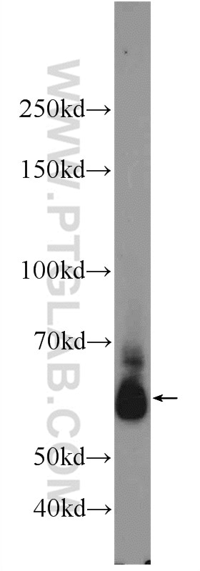 Western Blot (WB) analysis of Jurkat cells using RBM46 Polyclonal antibody (24368-1-AP)