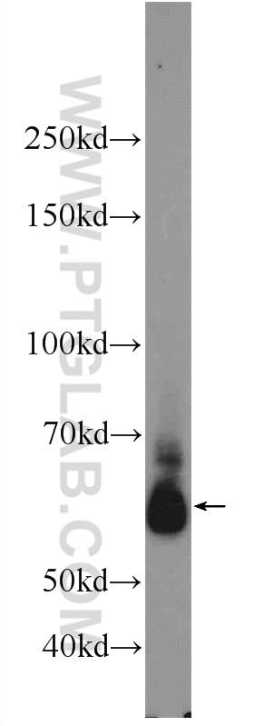 WB analysis of Jurkat using 24368-1-AP