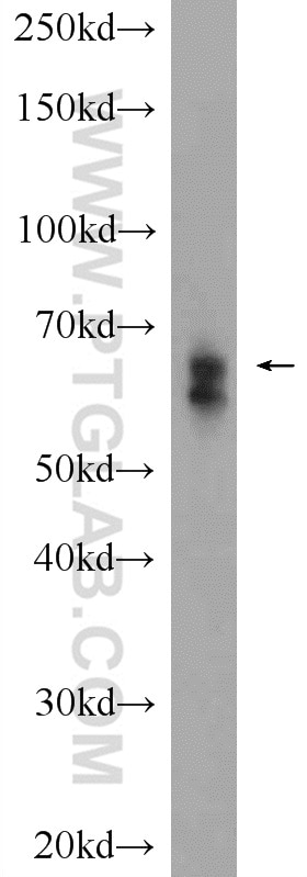 Western Blot (WB) analysis of rat lung tissue using RBM47 Polyclonal antibody (23902-1-AP)