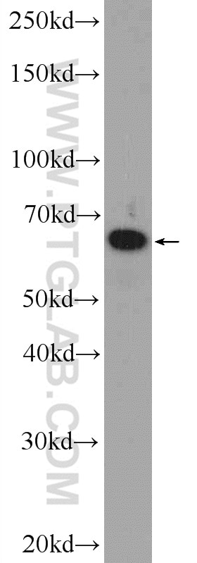 Western Blot (WB) analysis of A549 cells using RBM47 Polyclonal antibody (23902-1-AP)