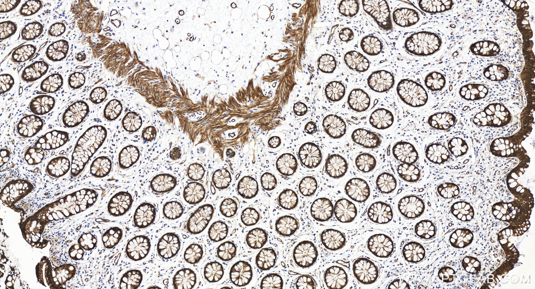 Immunohistochemistry (IHC) staining of human colon tissue using RBM47 Recombinant antibody (86009-1-RR)