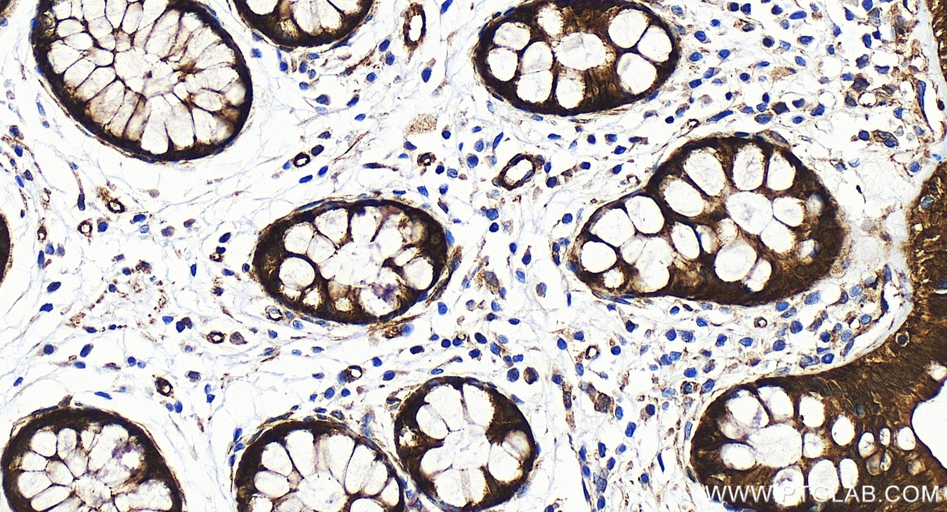Immunohistochemistry (IHC) staining of human colon tissue using RBM47 Recombinant antibody (86009-1-RR)