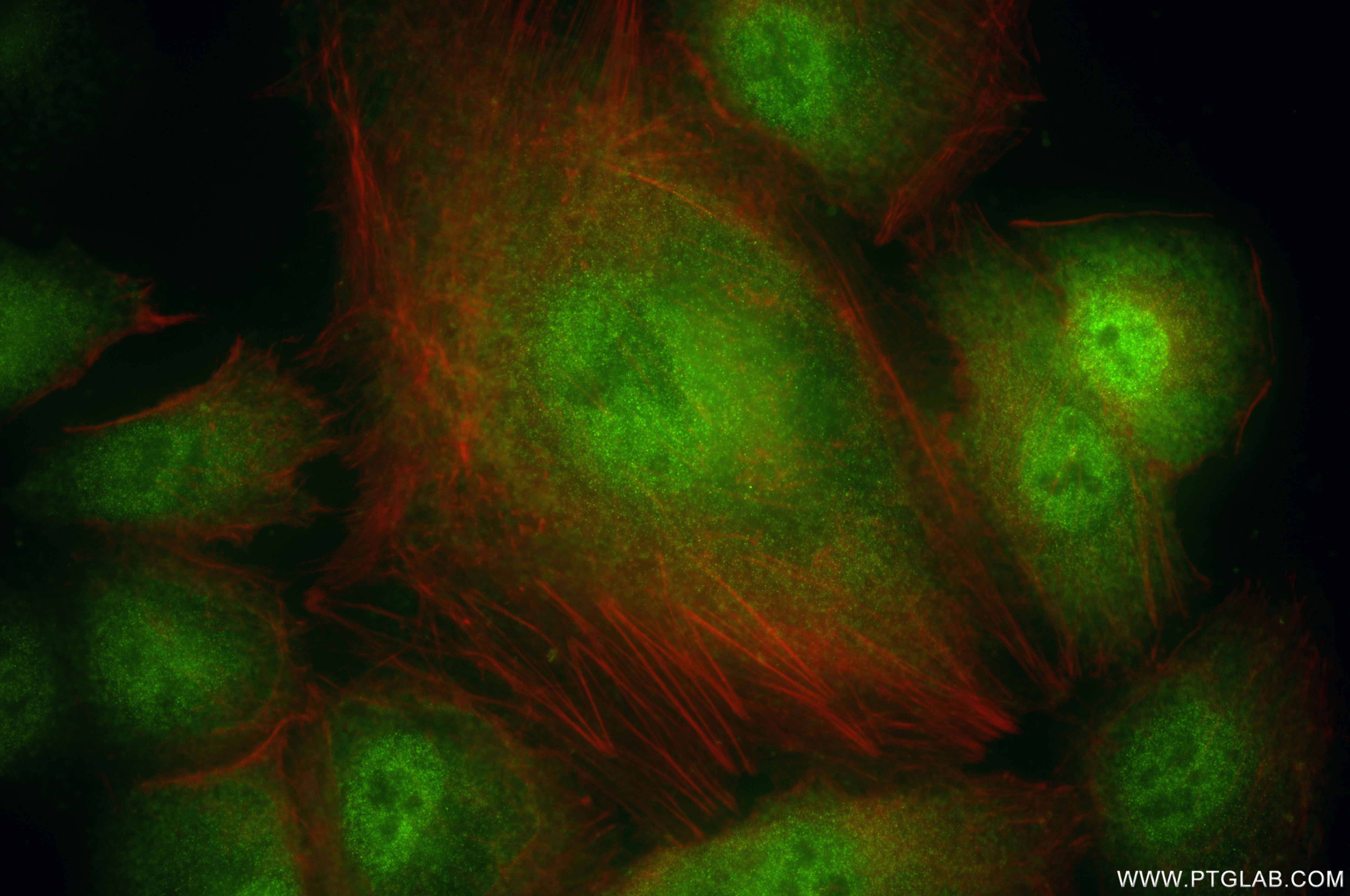 Immunofluorescence (IF) / fluorescent staining of A549 cells using RBM47 Recombinant antibody (86009-1-RR)
