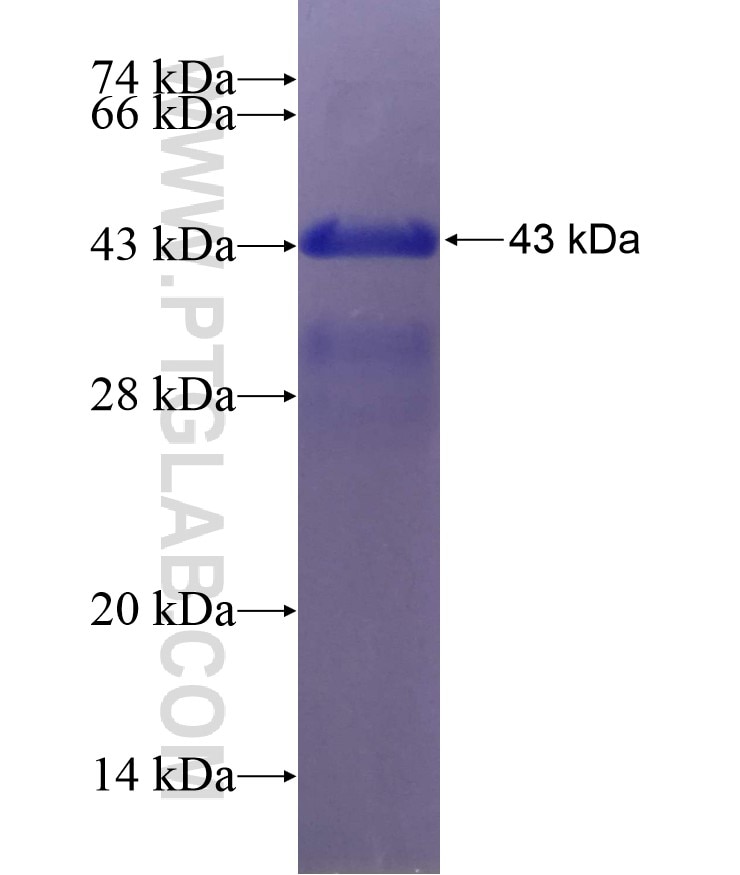 RBM47 fusion protein Ag20984 SDS-PAGE