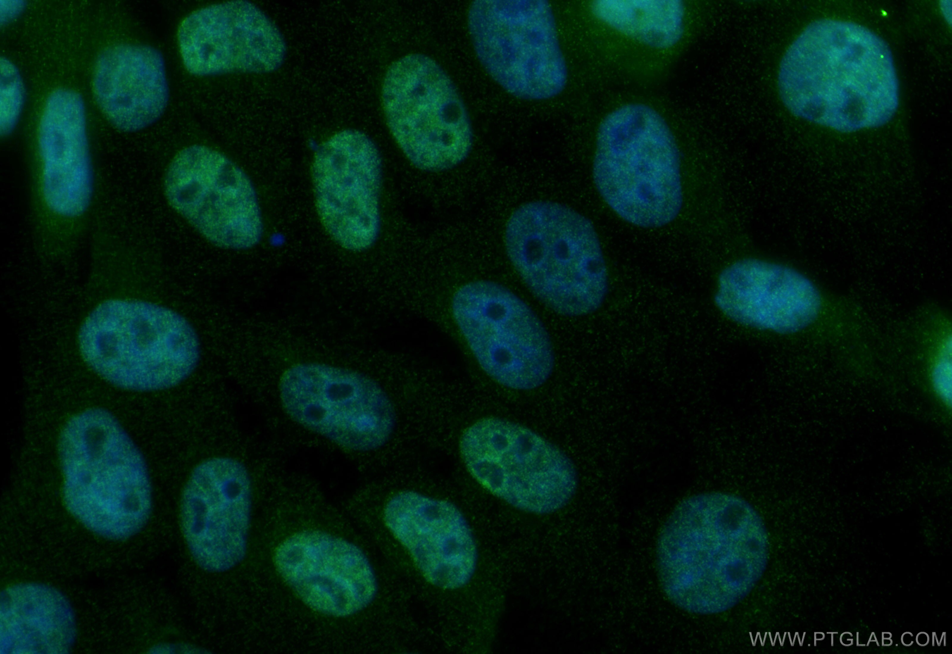 IF Staining of A431 using 28307-1-AP Immunofluorescence (IF) / fluorescent staining of A431 cells using RBM48 Polyclonal antibody (28307-1-AP)
