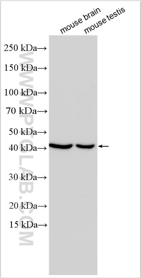 WB analysis using 28307-1-AP Western Blot (WB) analysis of various lysates using RBM48 Polyclonal antibody (28307-1-AP)