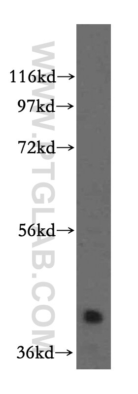 Western Blot (WB) analysis of HEK-293 cells using RBM4B Polyclonal antibody (15412-1-AP)