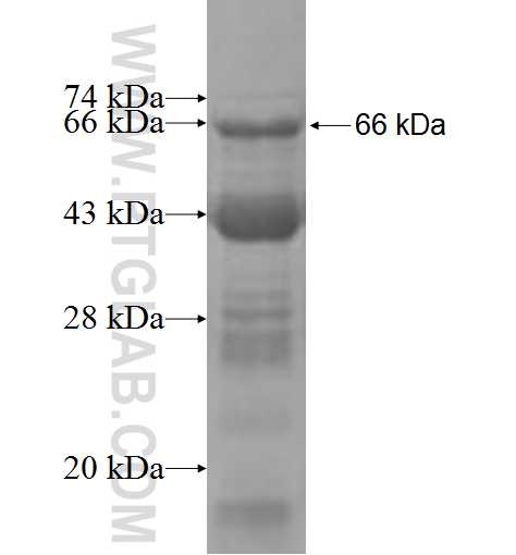 RBM4B fusion protein Ag7679 SDS-PAGE