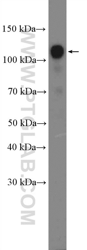 Western Blot (WB) analysis of PC-3 cells using RBM5 Polyclonal antibody (19930-1-AP)
