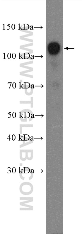 WB analysis of PC-3 using 19930-1-AP