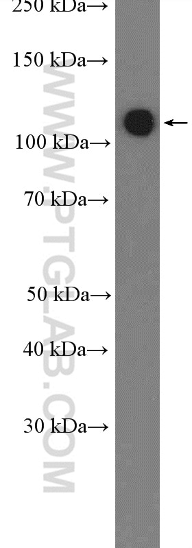 Western Blot (WB) analysis of PC-3 cells using RBM5 Polyclonal antibody (19930-1-AP)